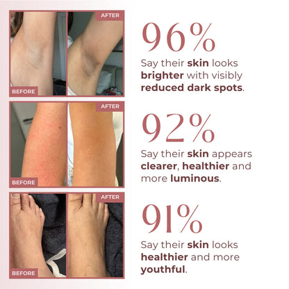 Peel Shot: Kojic Acid + Turmeric Body Exfoliator Spray