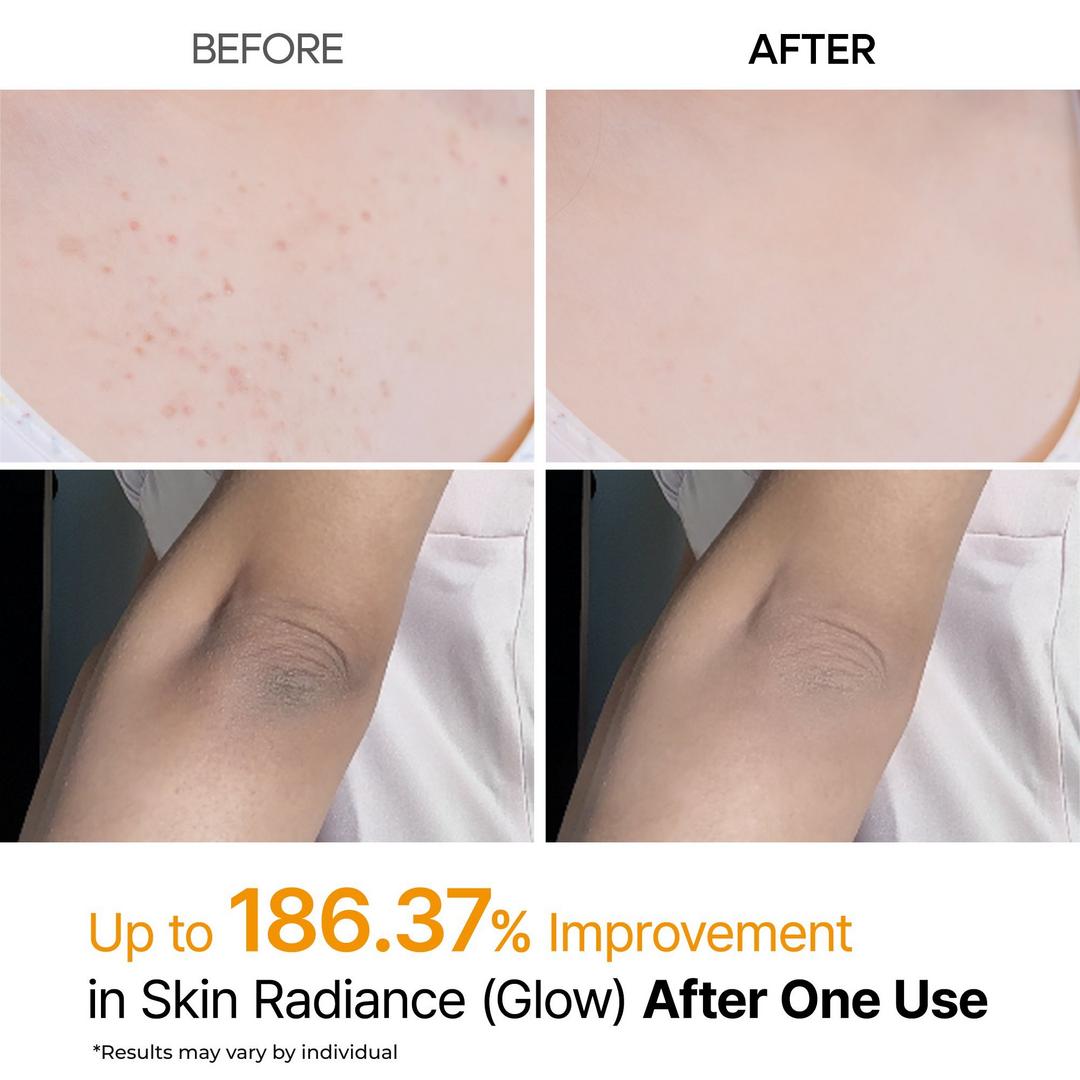 Peel Shot: Kojic Acid & Turmeric Body Exfoliator Spray