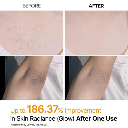 Peel Shot: Kojic Acid & Turmeric Body Exfoliator Spray