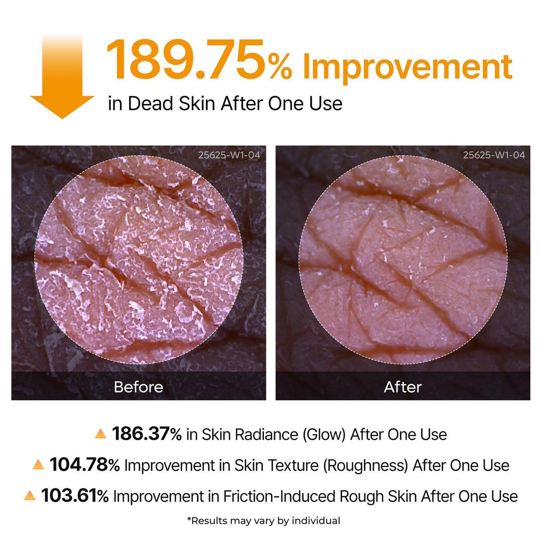 Peel Shot: Kojic Acid & Turmeric Body Exfoliator Spray