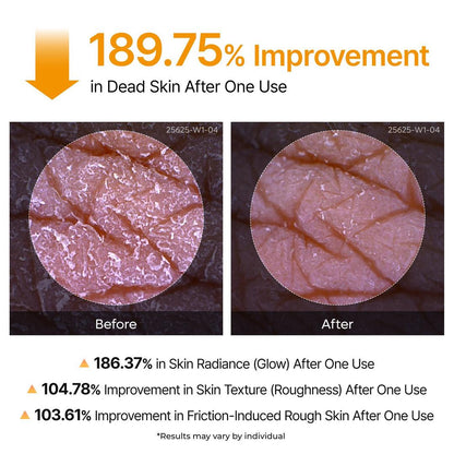 Peel Shot: Kojic Acid & Turmeric Body Exfoliator Spray