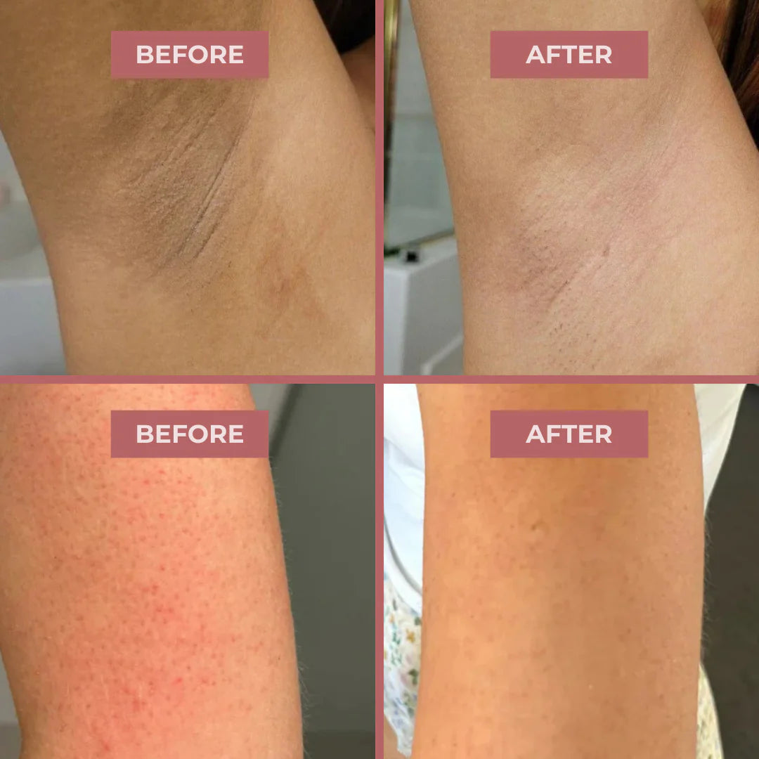 Peel Shot: Kojic Acid + Turmeric Body Exfoliator Spray